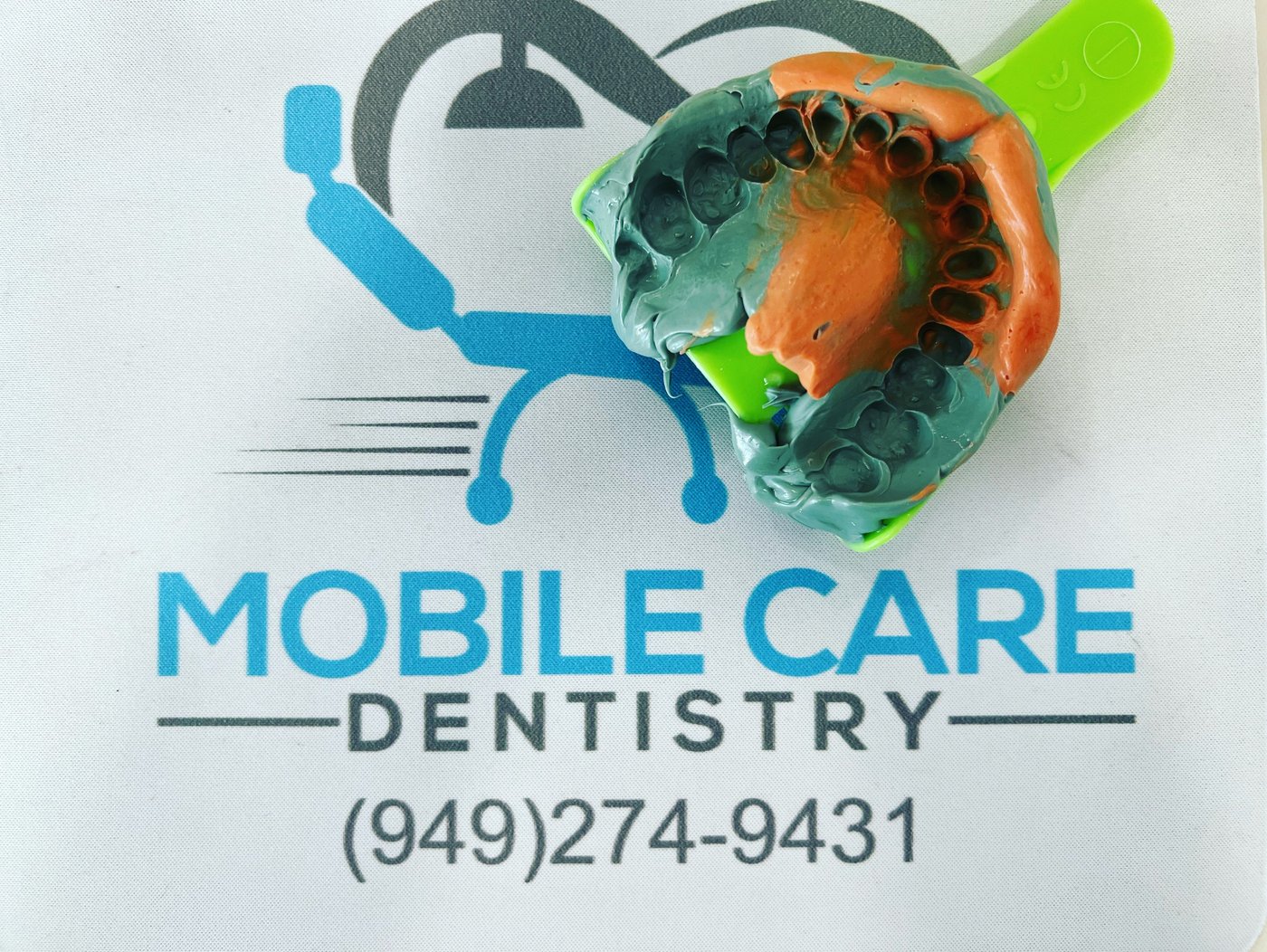 A dental impression for a custom restoration
